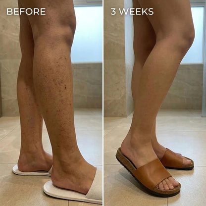 Layali Follicle Calm Oil – Your Post-Hair Removal Solution
